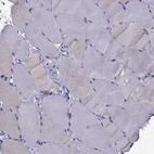 Immunohistochemical staining of human skeletal muscle shows no cytoplasmic positivity in myocytes as expected.