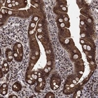 Anti-CDCA7L Antibody