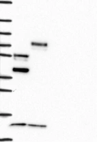 Lane 1: Marker [kDa] 250, 130, 95, 72, 55, 36, 28, 17, 10 | Lane 2: RT4 | Lane 3: U-251 MG | Lane 4: Human Plasma | Lane 5: Liver | Lane 6: Tonsil