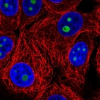 Immunofluorescent staining of human cell line MCF7 shows localization to nucleoli.