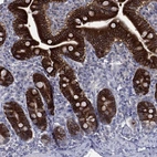 Anti-CES2 Antibody