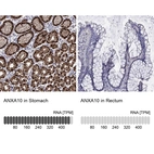 Anti-ANXA10 Antibody