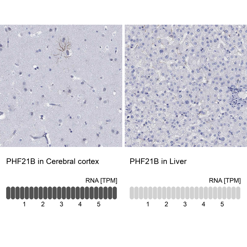 Anti-PHF21B Antibody