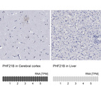 Anti-PHF21B Antibody