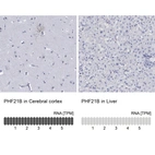 Anti-PHF21B Antibody