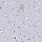 Immunohistochemical staining of human cerebral cortex shows high expression.