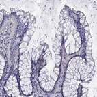 Immunohistochemical staining of human rectum shows low expression as expected.