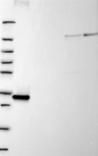 Lane 1: Marker [kDa] 250, 130, 95, 72, 55, 36, 28, 17, 10 | Lane 2: RT4 | Lane 3: U-251 MG | Lane 4: Human Plasma | Lane 5: Liver | Lane 6: Tonsil