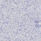 Anti-PHF21B Antibody