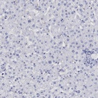 Immunohistochemical staining of human liver shows low expression as expected.