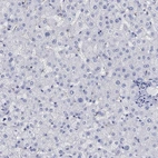 Immunohistochemical staining of human liver shows low expression as expected.