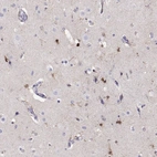 Immunohistochemical staining of human cerebral cortex shows strong cytoplasmic positivity in astrocytes.