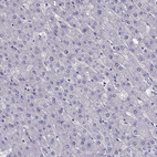 Anti-LINGO1 Antibody
