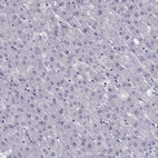 Immunohistochemical staining of human liver shows negative cytoplasmic positivity in hepatocytes.