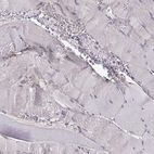 Immunohistochemical staining of human skeletal muscle shows negative cytoplasmic positivity in myocytes.
