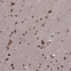 Anti-PTOV1 Antibody