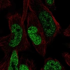Anti-FGGY Antibody
