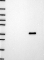 Anti-SPTLC2 Antibody