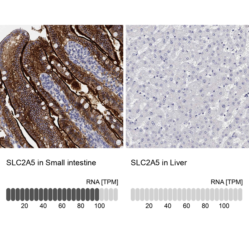 Anti-SLC2A5 Antibody
