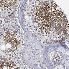Immunohistochemical staining of human testis shows strong membranous positivity in cells in seminiferous ducts.