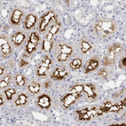 Immunohistochemical staining of human kidney shows moderate membranous positivity in cells in tubules.