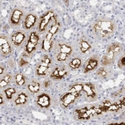 Immunohistochemical staining of human kidney shows moderate membranous positivity in cells in tubules.