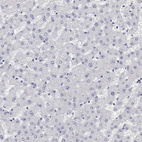Immunohistochemical staining of human liver shows no positivity in hepatocytes.