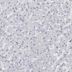 Immunohistochemical staining of human liver shows no positivity in hepatocytes.