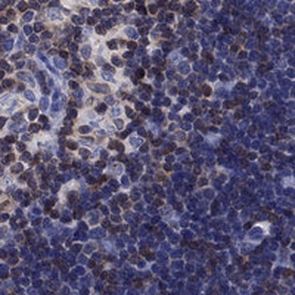 Anti-LIMD2 Antibody