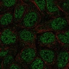 Immunofluorescent staining of human cell line A-431 shows localization to nucleoplasm.