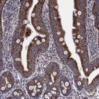 Anti-PNPLA2 Antibody