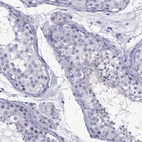 Immunohistochemical staining of human testis shows high expression.