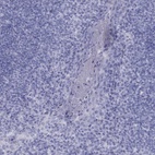 Anti-FSCN3 Antibody