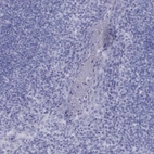 Immunohistochemical staining of human tonsil shows low expression as expected.