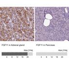 Anti-FGF11 Antibody