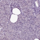 Immunohistochemical staining of human pancreas shows low expression as expected.