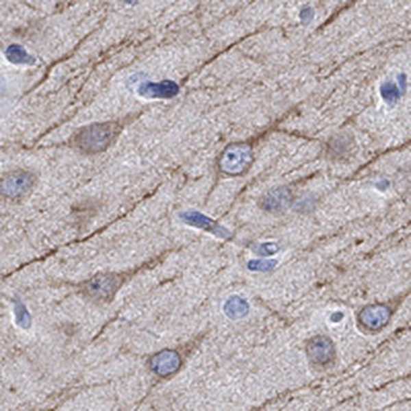 Anti-CAMK2N2 Antibody