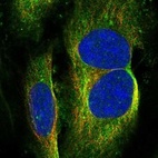 Anti-GRAMD1B Antibody