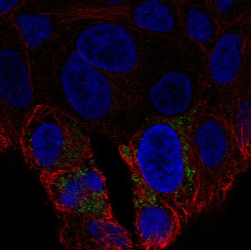 Anti-UCP2 Antibody