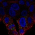 Anti-UCP2 Antibody
