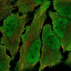 Anti-TOGARAM2 Antibody