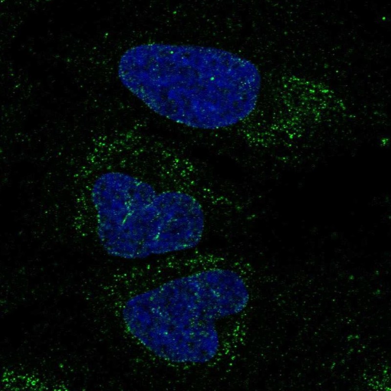 Anti-FXYD6-FXYD2 Antibody