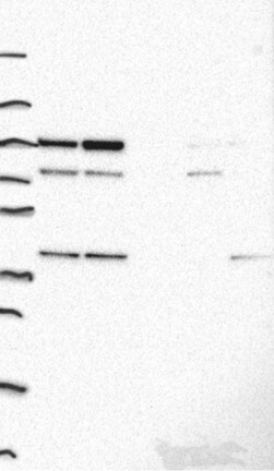 Anti-ADK Antibody