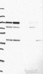 Anti-ADK Antibody