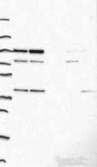 Anti-ADK Antibody