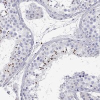 Anti-C10orf90 Antibody