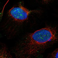 Anti-EXOSC8 Antibody