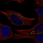 Anti-COMMD2 Antibody