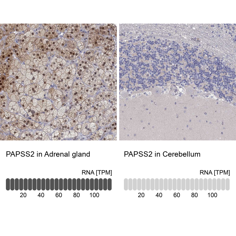Anti-PAPSS2 Antibody