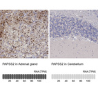 Anti-PAPSS2 Antibody
